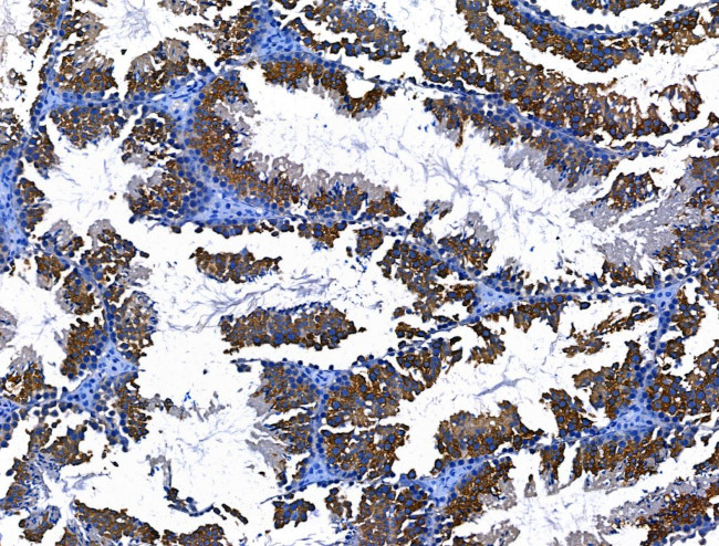 BRUCE Antibody in Immunohistochemistry (Paraffin) (IHC (P))