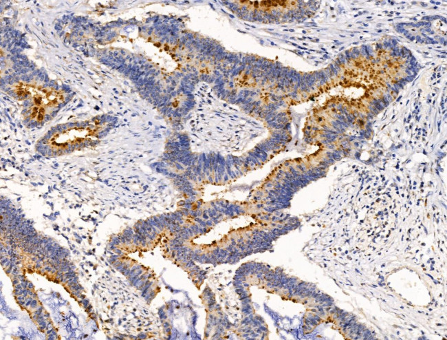 BRUCE Antibody in Immunohistochemistry (Paraffin) (IHC (P))