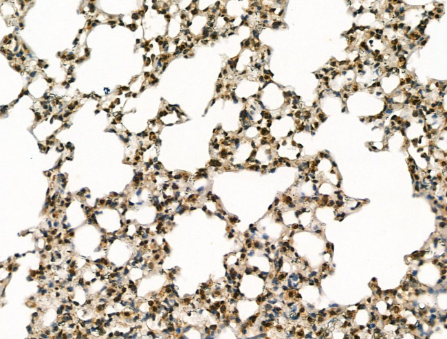 BLM Antibody in Immunohistochemistry (Paraffin) (IHC (P))