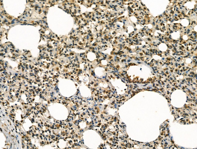 BLM Antibody in Immunohistochemistry (Paraffin) (IHC (P))