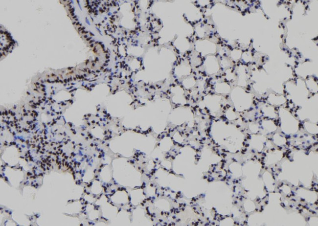 B-Myb Antibody in Immunohistochemistry (Paraffin) (IHC (P))