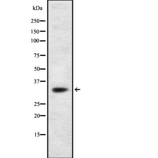 BNIP3L Antibody in Western Blot (WB)