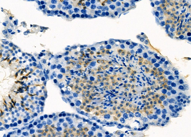 IBSP Antibody in Immunohistochemistry (Paraffin) (IHC (P))