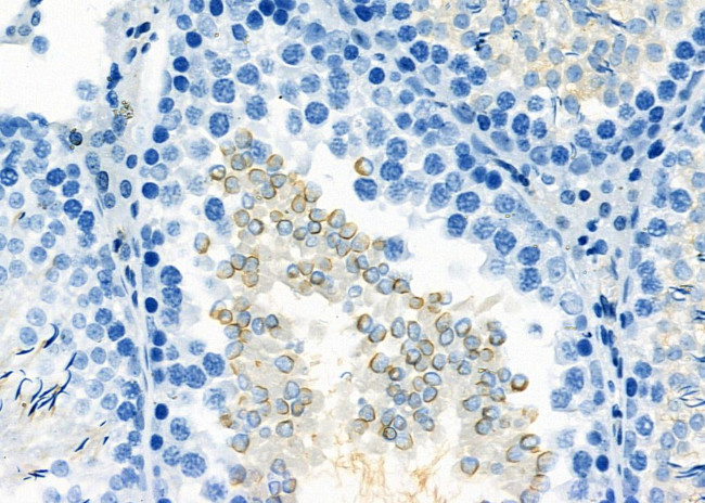 IBSP Antibody in Immunohistochemistry (Paraffin) (IHC (P))