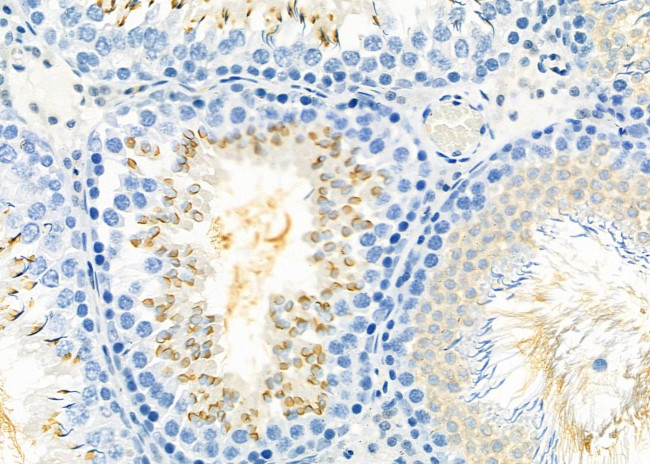 IBSP Antibody in Immunohistochemistry (Paraffin) (IHC (P))