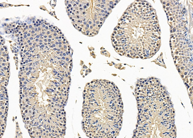 Brachyury Antibody in Immunohistochemistry (Paraffin) (IHC (P))