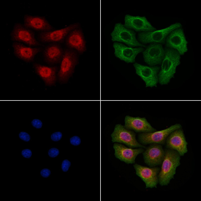 Brachyury Antibody in Immunocytochemistry (ICC/IF)