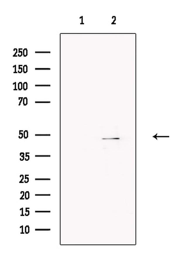 Brachyury Antibody in Western Blot (WB)