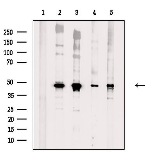 Brachyury Antibody in Western Blot (WB)