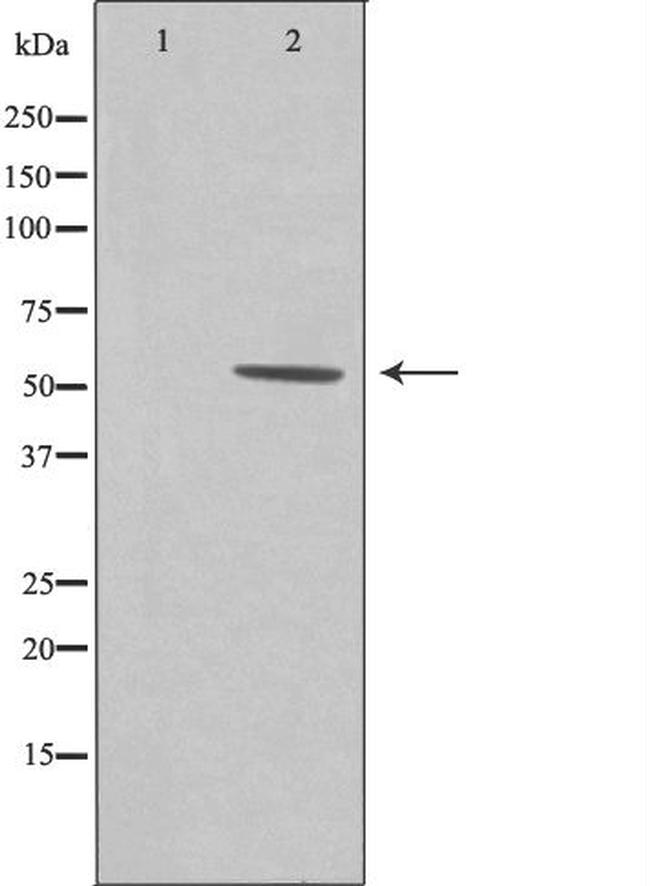 ZNHIT6 Antibody in Western Blot (WB)