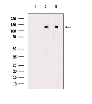 CACNA2D1 Antibody in Western Blot (WB)