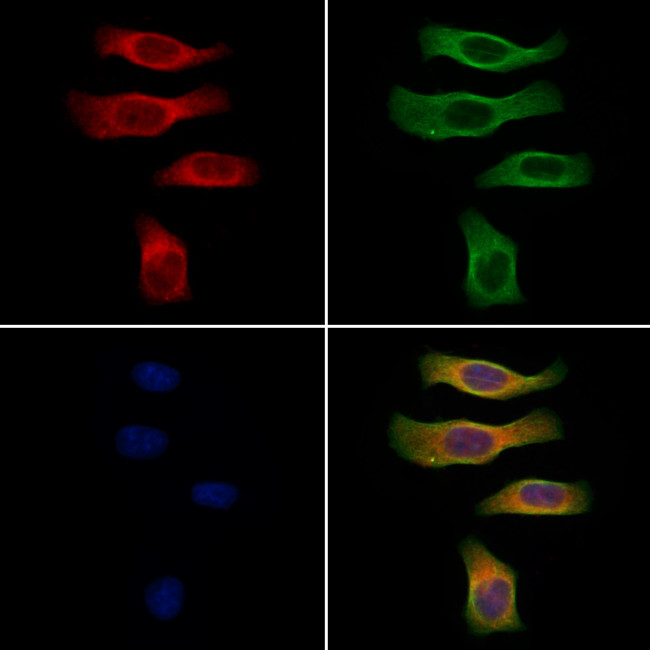 CGRP Antibody in Immunocytochemistry (ICC/IF)