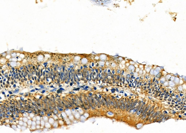 CGRP Antibody in Immunohistochemistry (Paraffin) (IHC (P))