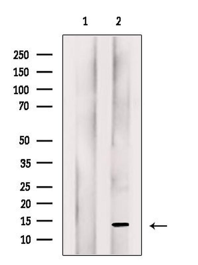 CGRP Antibody in Western Blot (WB)