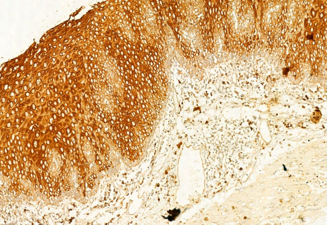 Calnexin Antibody in Immunohistochemistry (Paraffin) (IHC (P))