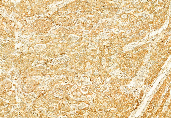 Calnexin Antibody in Immunohistochemistry (Paraffin) (IHC (P))