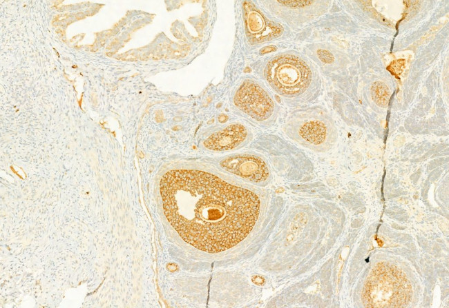 Calnexin Antibody in Immunohistochemistry (Paraffin) (IHC (P))