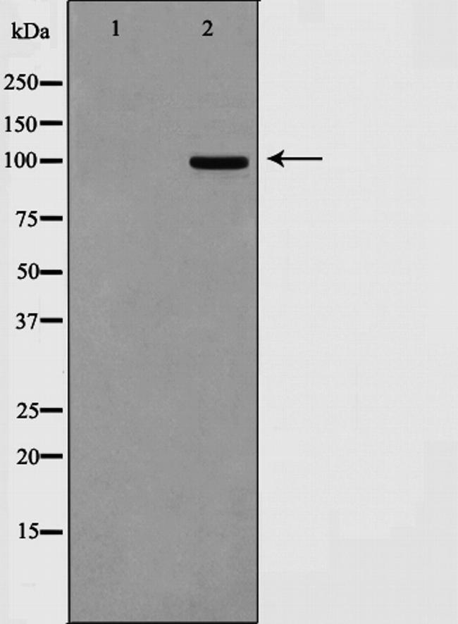 Calnexin Antibody in Western Blot (WB)