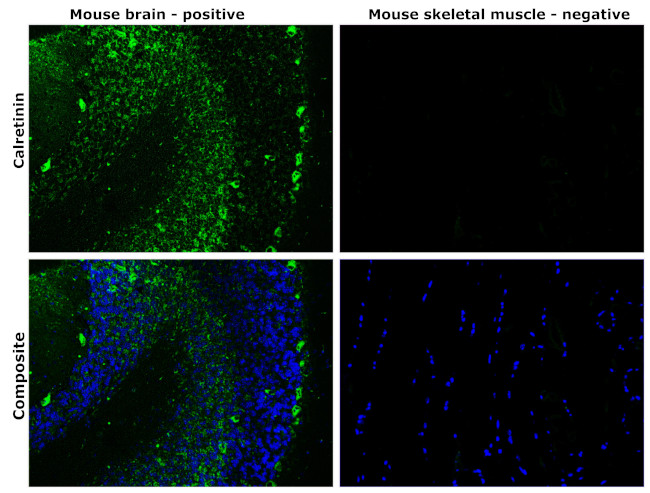 Calretinin Antibody in Immunohistochemistry (Paraffin) (IHC (P))