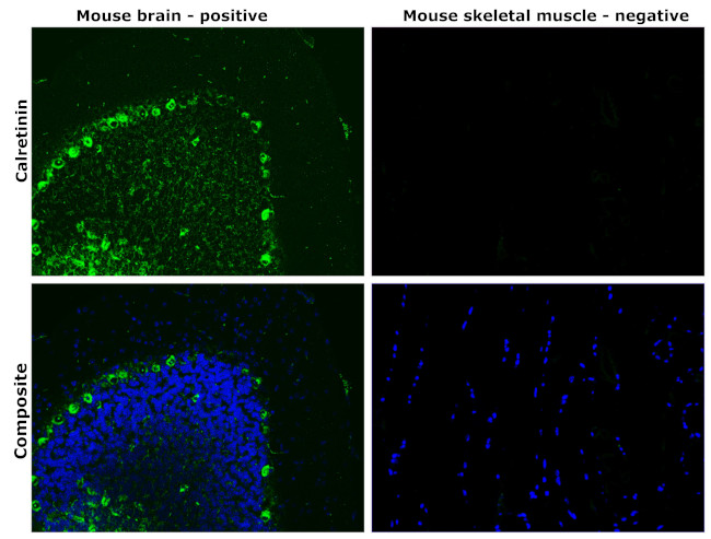 Calretinin Antibody in Immunohistochemistry (Paraffin) (IHC (P))