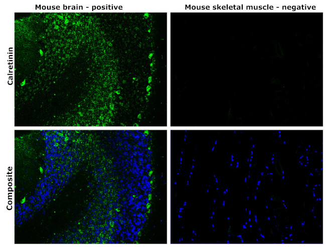 Calretinin Antibody