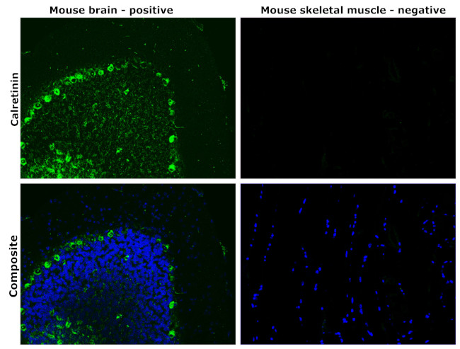 Calretinin Antibody