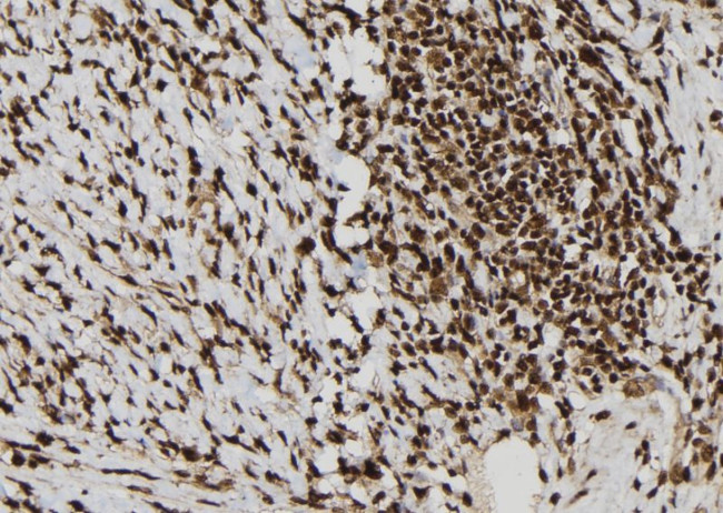 Calretinin Antibody in Immunohistochemistry (Paraffin) (IHC (P))