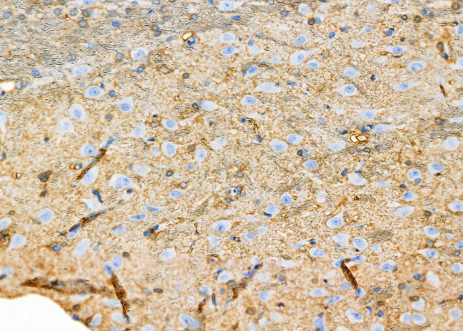 Calretinin Antibody in Immunohistochemistry (Paraffin) (IHC (P))