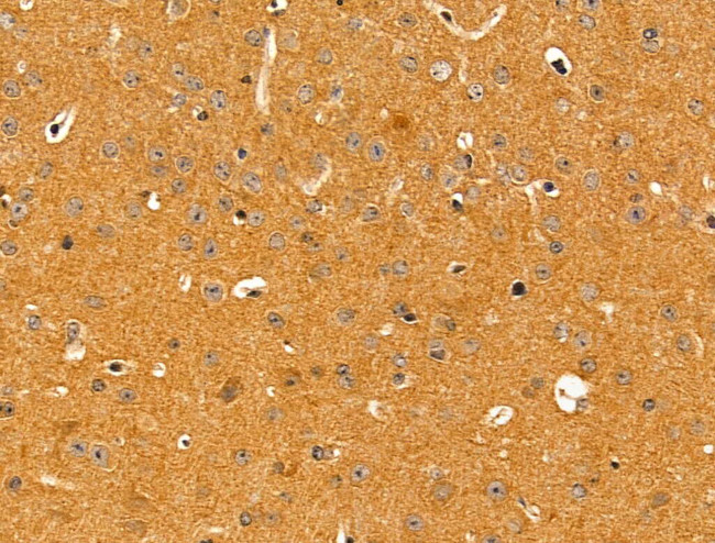 KChIP3 Antibody in Immunohistochemistry (Paraffin) (IHC (P))