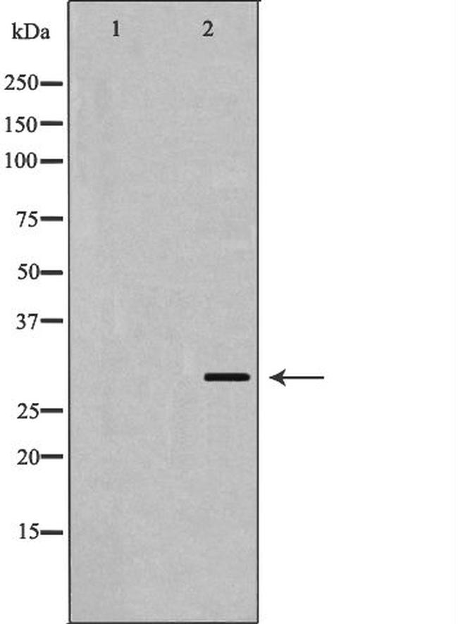 KChIP3 Antibody in Western Blot (WB)