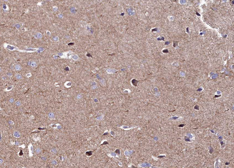 CaMKII alpha/delta Antibody in Immunohistochemistry (Paraffin) (IHC (P))