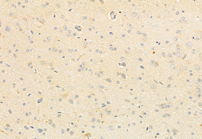 CaMKII alpha/delta Antibody in Immunohistochemistry (Paraffin) (IHC (P))