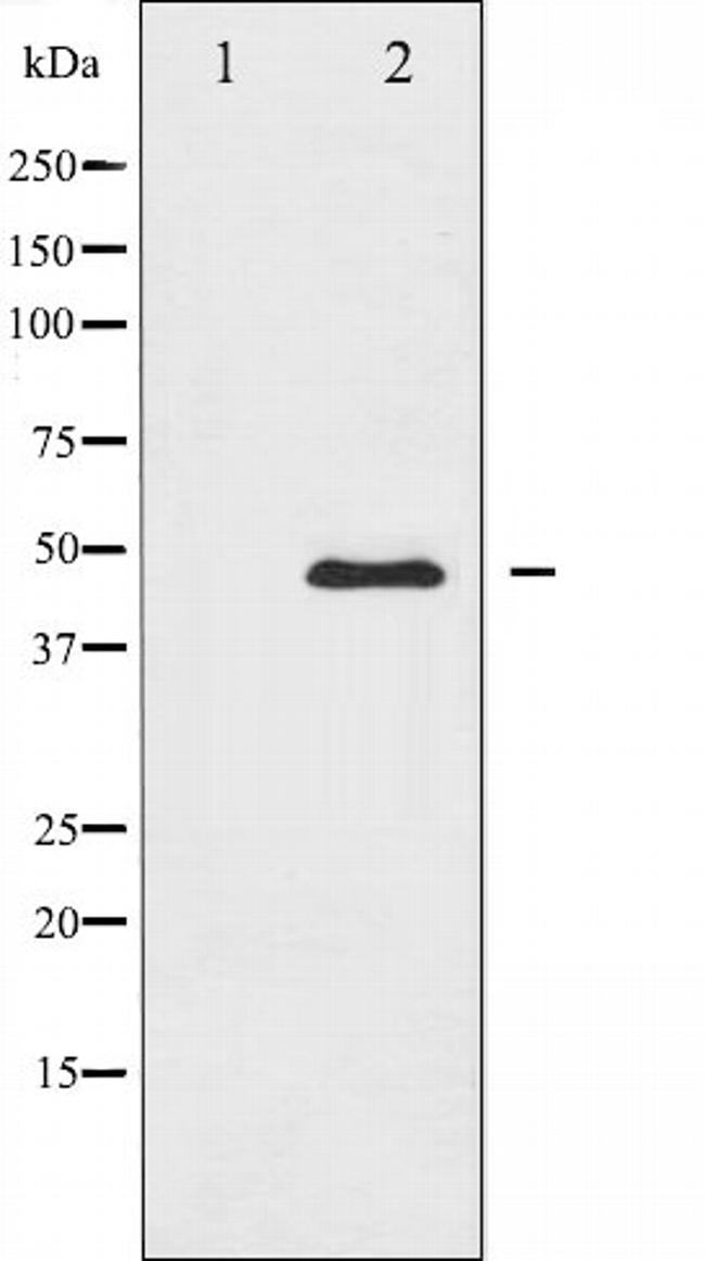 CaMKII alpha/delta Antibody in Western Blot (WB)