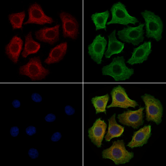 CaMKII delta Antibody in Immunocytochemistry (ICC/IF)