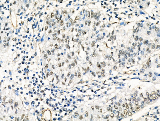 HP1 beta Antibody in Immunohistochemistry (Paraffin) (IHC (P))