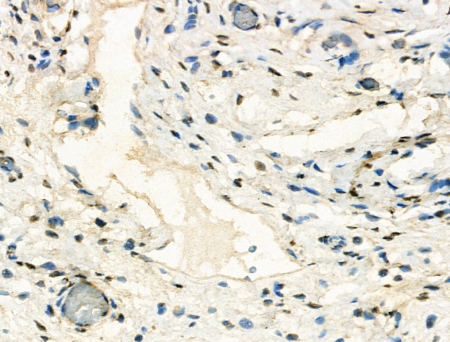 HP1 beta Antibody in Immunohistochemistry (Paraffin) (IHC (P))