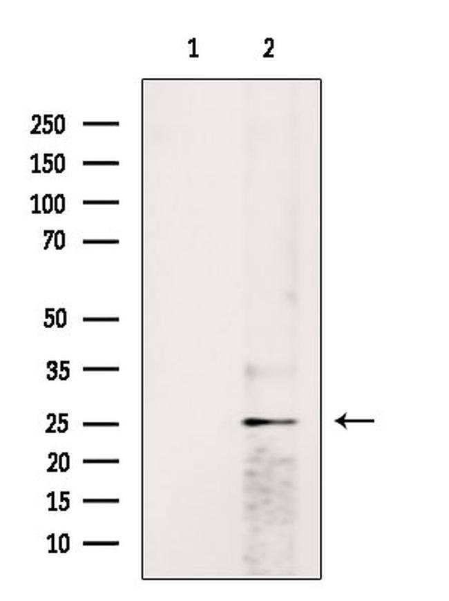 HP1 beta Antibody in Western Blot (WB)