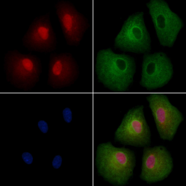 CBX4 Antibody in Immunocytochemistry (ICC/IF)