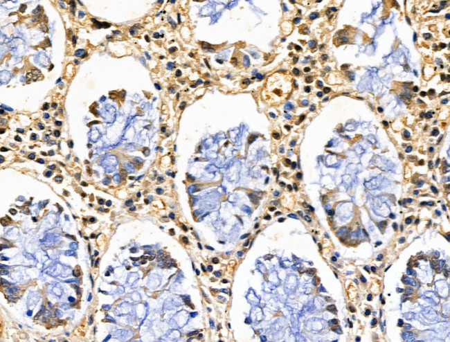 CBX4 Antibody in Immunohistochemistry (Paraffin) (IHC (P))