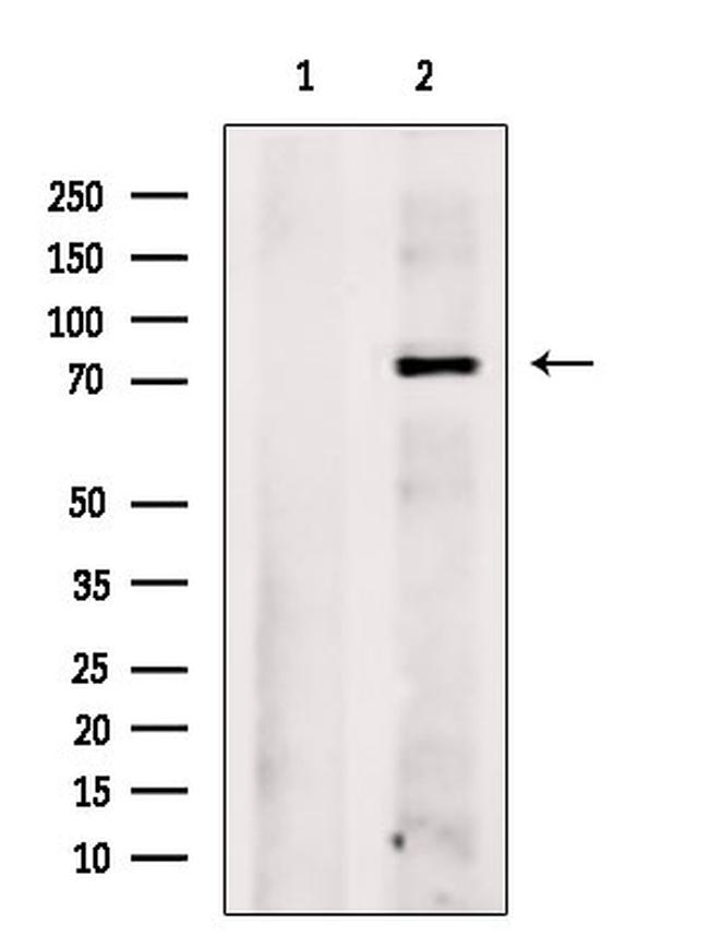 CBX4 Antibody in Western Blot (WB)