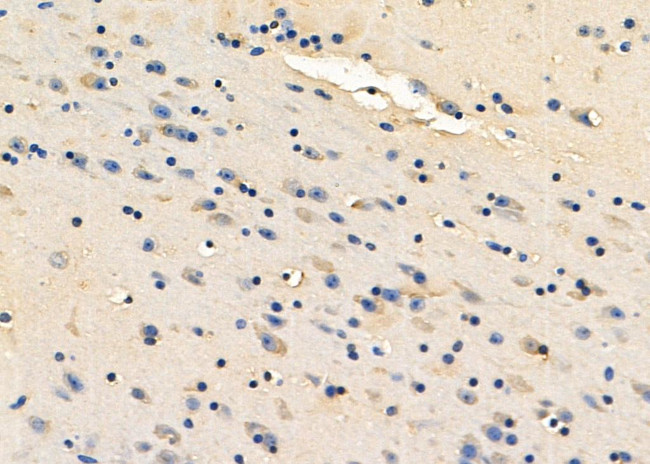 Eotaxin Antibody in Immunohistochemistry (Paraffin) (IHC (P))