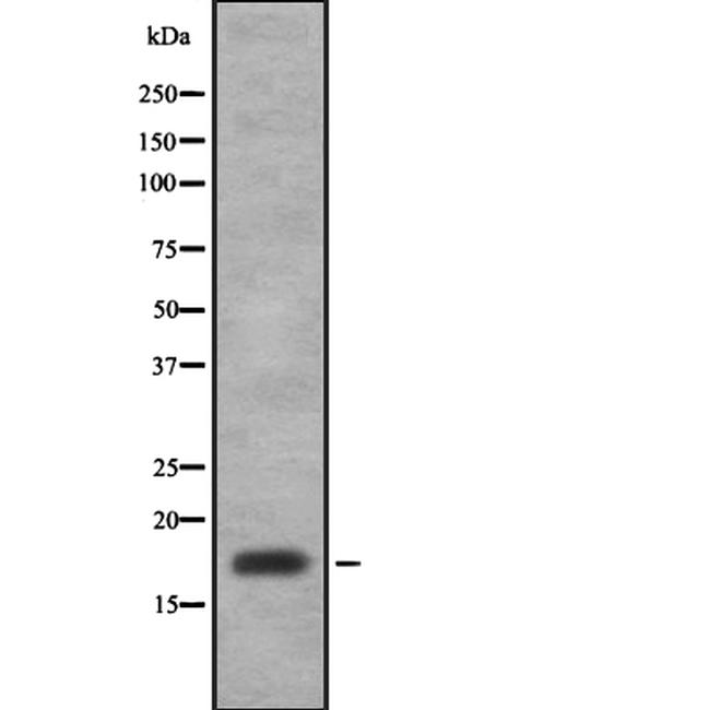 Eotaxin Antibody in Western Blot (WB)