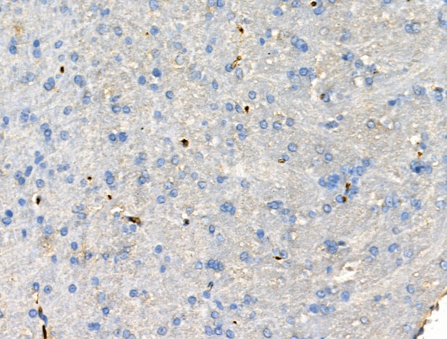 CCL14 Antibody in Immunohistochemistry (Paraffin) (IHC (P))