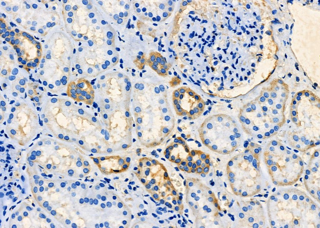 TARC Antibody in Immunohistochemistry (Paraffin) (IHC (P))