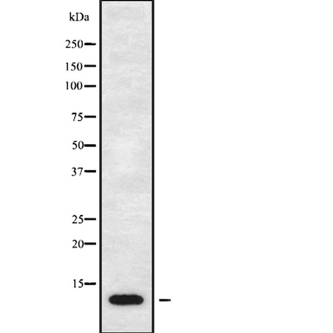 TARC Antibody in Western Blot (WB)