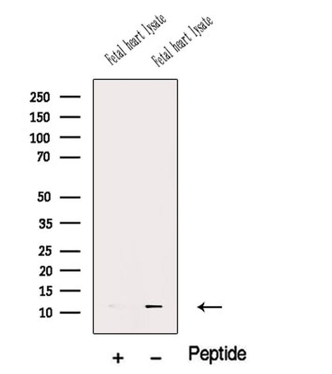 MCP-2 Antibody in Western Blot (WB)