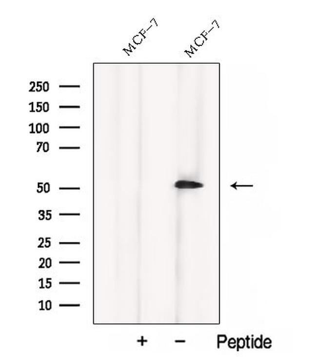 CCM2 Antibody in Western Blot (WB)