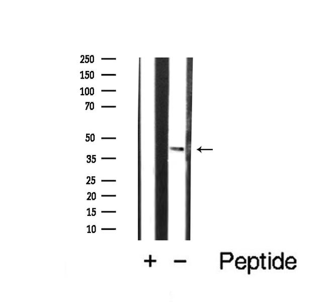 CCR5 Antibody in Western Blot (WB)