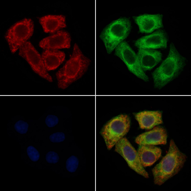 CCR8 Antibody in Immunocytochemistry (ICC/IF)