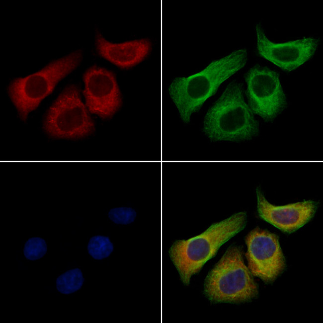 CD1a Antibody in Immunocytochemistry (ICC/IF)